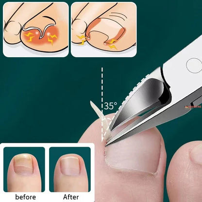 NailCare Pro™ - Nail Cutter